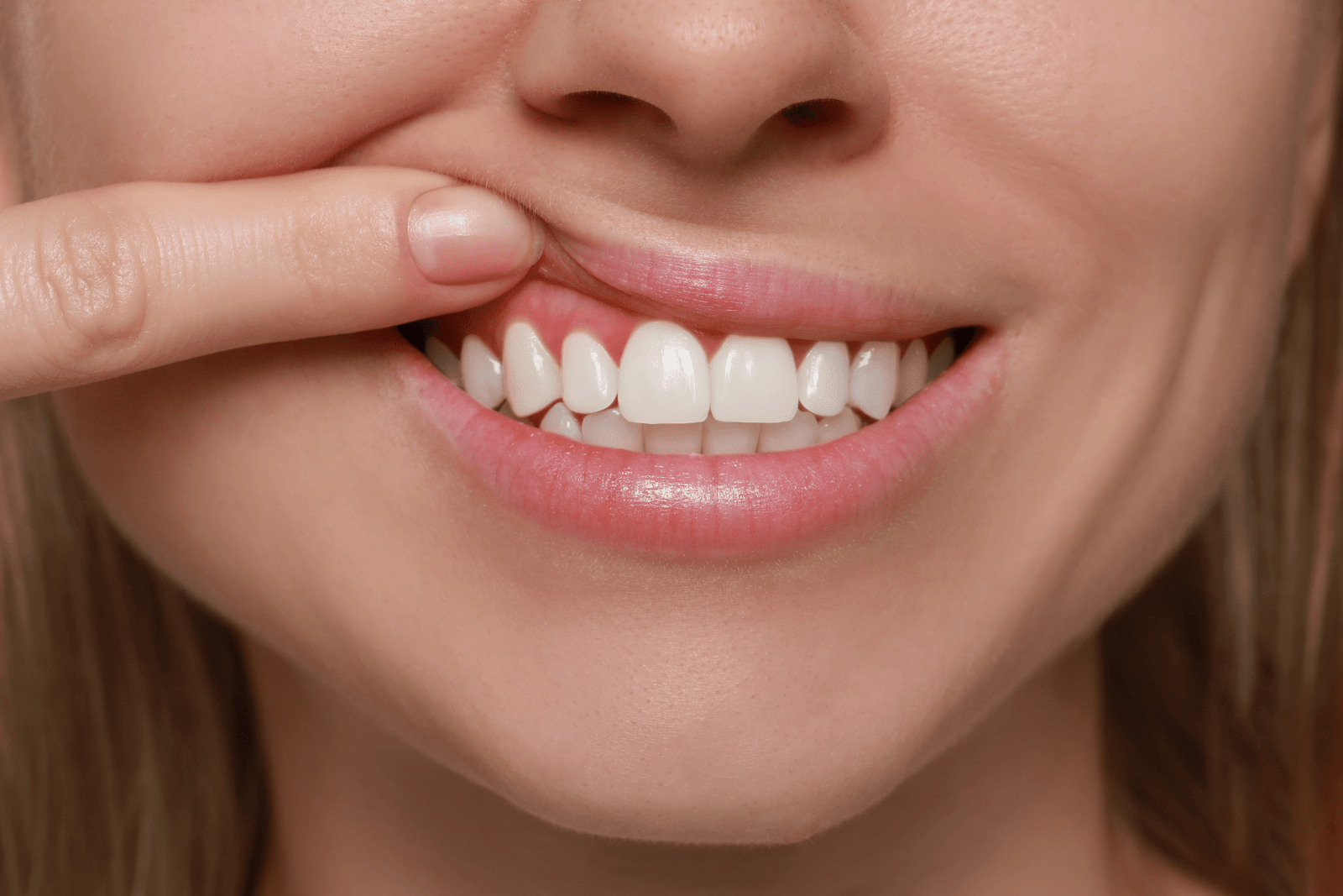 gingivitas Altadenta